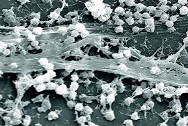 Electron micrograph image of a biofilm at 21, 850x magnification. Biofilms typically consist of structured communities of bacteria and an extracellular polysaccharide matrix that promotes surface adhesion.
